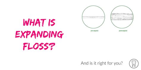 What is Expanding Floss? | The Toothsayer