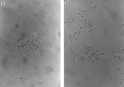 Morphology Of Sk N Sh Neuroblastoma Cells Grown With No Additions To