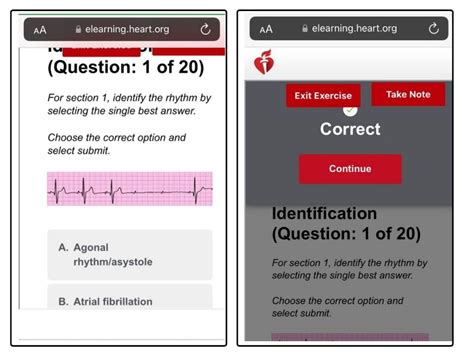 Acls Pretest Answers Acls Pretest And Answers Part