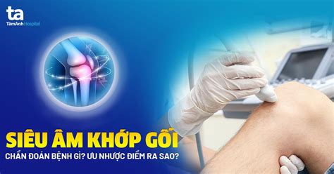 Siêu âm khớp Đối tượng chỉ định và quy trình thực hiện