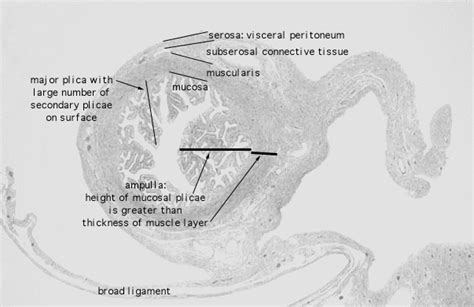 Hls Female Reproductive System Oviduct Ampulla Low Mag Labeled