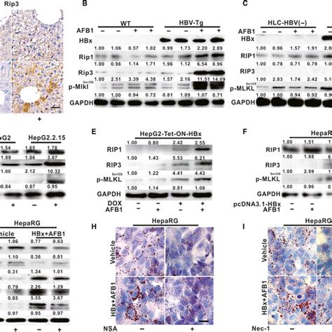 Hepatitis B Virus X Protein Hbx And Aflatoxin B Afb Induced