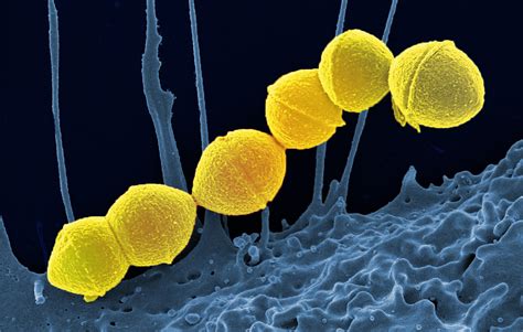 Toxic Shock Syndrome Bacteria