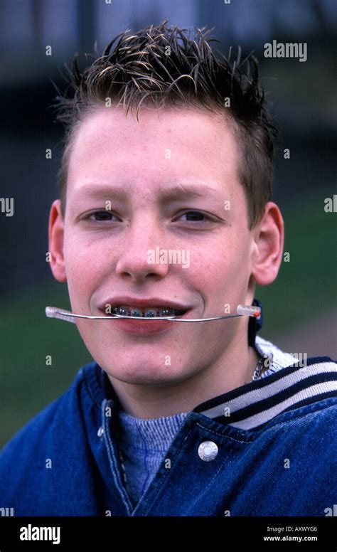 Headgear braces hi-res stock photography and images - Alamy