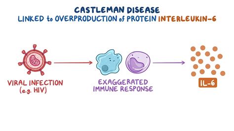 Castleman Disease Year Of The Zebra Video Anatomy Osmosis