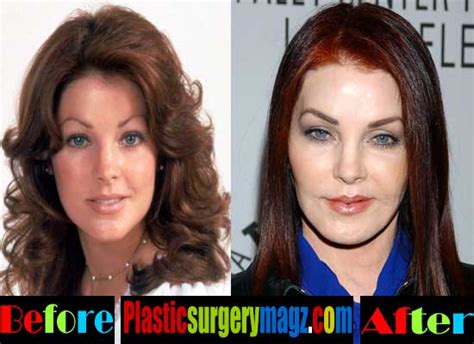 Priscilla Presley Plastic Surgery Disaster | | Plastic Surgery Magazine