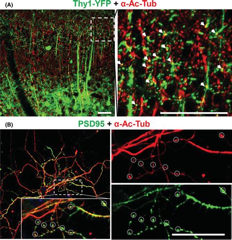 Colocalization Of Acetylated α‐tubulin α‐ac‐tub With The Dendritic