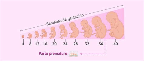 Qu Es El Parto Prematuro O Pret Rmino