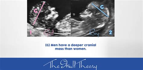 The Skull Theory - The Physical Attributes of your Baby's Skull Matter ...