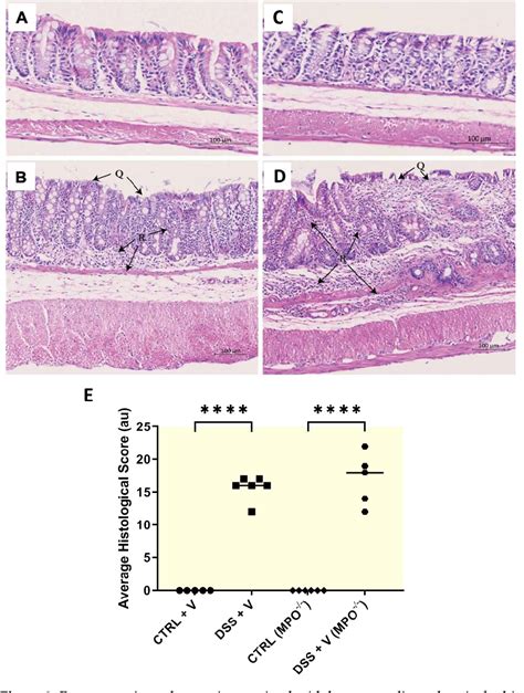 Figure From Myeloperoxidase Gene Deletion Causes Drastic Microbiome