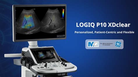 MediGroup Cambodia I LOGIQ P10 With XDClear GE Healthcare YouTube