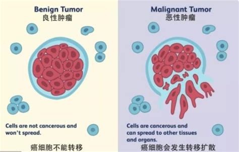 简单易懂！肿瘤和癌症，有怎样的联系和区别？中国医疗