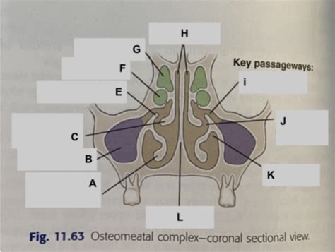 Chapter 11 Sinuses Mandible And Tmj Labeling Flashcards Quizlet