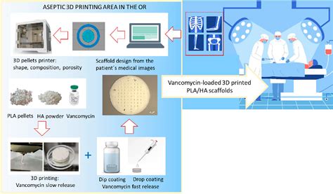 Figure 1 From Vancomycin Loaded 3D Printed Polylactic Acid