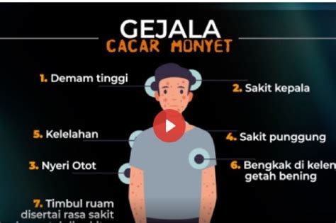 Kenali Gejala Dan Cara Pencegahan Penularan Cacar Monyet Antara News