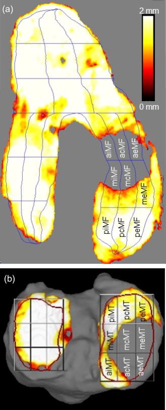 Association Between Knee Cartilage Thickness Determined By Magnetic