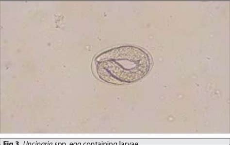 Figure 3 From First Report On Heavy Uncinaria Dochmoides Sp Nematoda Ancylostomatidae