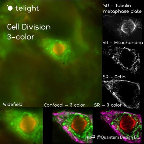 让细胞观测活起来LiveCodim模块化超分辨共聚焦显微镜全新来袭 知乎