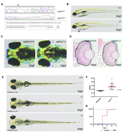 Generation Of Nphs1 Mutant Zebrafish By CRISPR Cas9 Mediated Gene