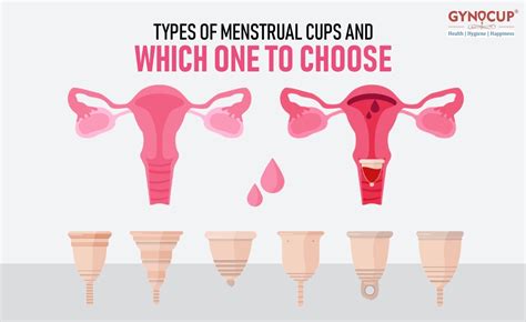 Types Of Menstrual Cups And Which One To Choose Gynocup