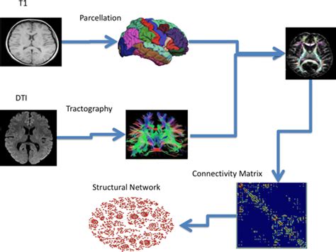 Construction Of Structural Connectivity Network Diffusion Tensor Download Scientific Diagram