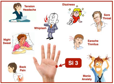 The Small Intestine Meridian and its 19 Acupuncture Points