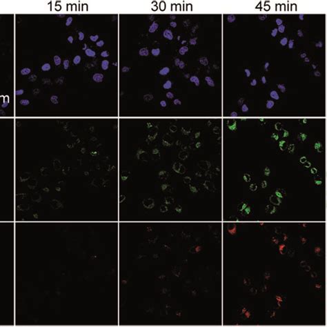 Confocal images of HeLa cells incubated with Probe 1 10 μM for 2 h