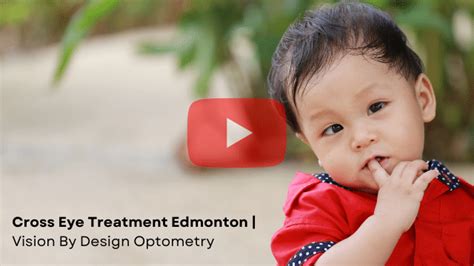 Cross Eye Treatment Edmonton | Neglected Strabismus Symptoms