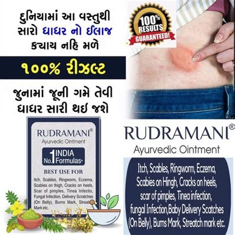 Rudramani Ayurvedic Fungal Ointment 25gm At Rs 100 Piece Antifungal