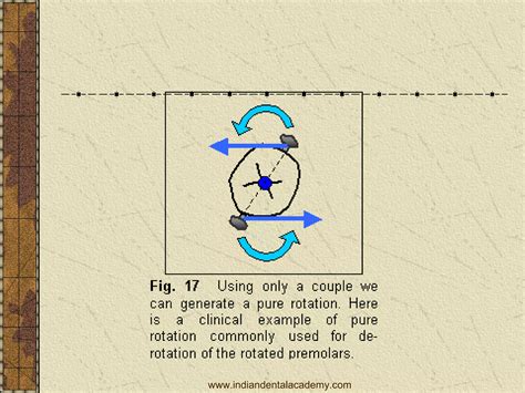 biomechanical principles in orthodontics / prosthodontic courses | PPT