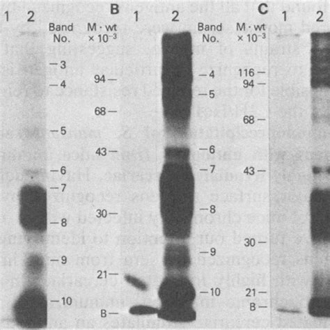 Autoradiograph Of Sds Polyacrylamide Gel Electrophoresis Of