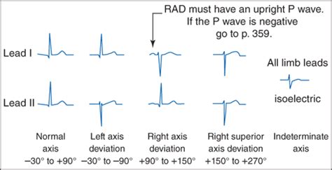 Basic Electrocardiography Guide To Diagnostic Tests