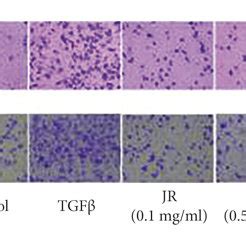 JR inhibits TGFβ1 induced migration and invasion of HCC cells The