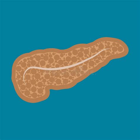 Pancreatitis Medizinische Illustration Von Krankheiten Des Pankreas