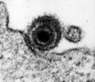 Epstein Barr Virus Von Harmlos Bis Folgenschwer Gesundheitsforschung