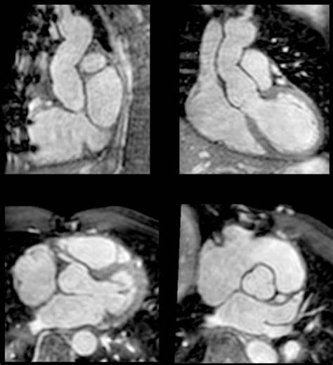 Scmr Position Paper 2020 On Clinical Indications For Cardiovascular