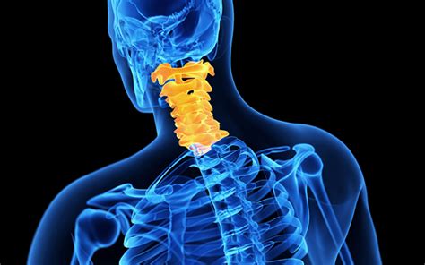 Total 61 Imagem Cirurgia De Bico De Papagaio Na Cervical Br