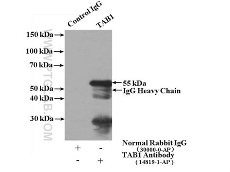 Tab1 Rabbit Anti Human Mouse Rat Polyclonal Proteintech 150 μl