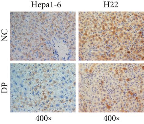 Dp Decreases The Expression Of Hepcidin In Vivo A Download