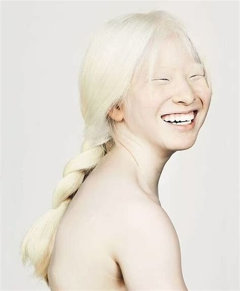 Albino Model Xueli Abbing Is Breaking Barriers In The Modelling World