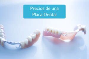 Cuánto Cuesta una Placa Dental en Estados Unidos en 2023 Clínica dental