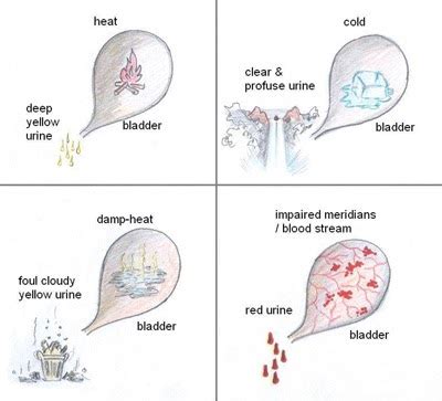 Kidney disease Urine odor