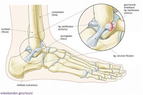 Ligaments Of The Foot And Ankle Wikimsk Atelier Yuwa Ciao Jp