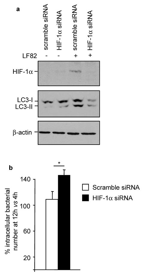 Ijms Free Full Text Yersiniabactin Siderophore Of Crohns Disease Associated Adherent