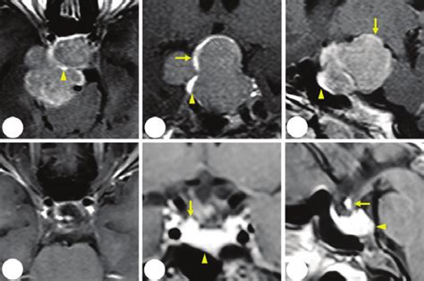 Patient 5 Representative Post Contrast T1 Weighted Images