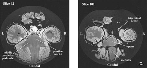 Brain of the African elephant (Loxodonta africana): Neuroanatomy from magnetic resonance images ...