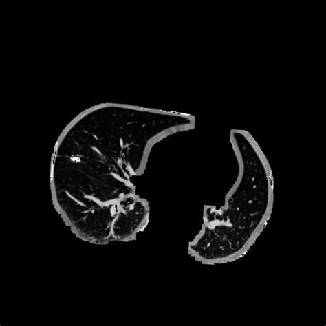 Lung Nodule Instance Segmentation Dataset By Irgi Azarya