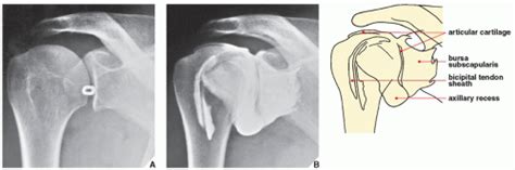 Upper Limb I Shoulder Girdle Radiology Key