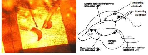 The Above Images Show Typical Placement Of Recording And Stimulating Download Scientific