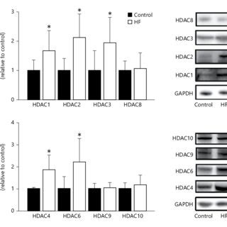 Expression Levels Of Class I And Class II HDACs In HF The LVs Of The